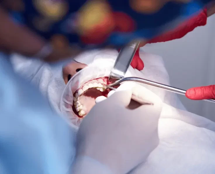 A clinician performing a bone grafting procedure