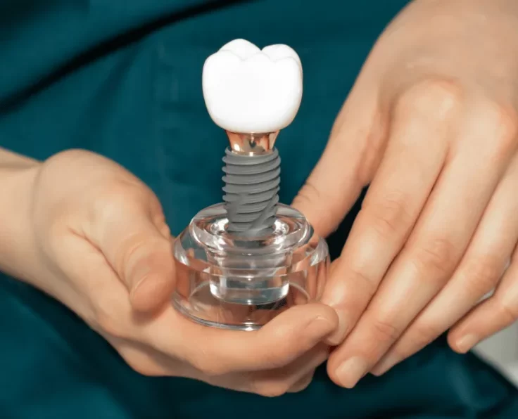 Hands holding a model of a single implant with its crown